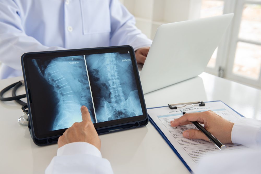 Minimally Invasive Lumbar Discectomy: Basics, Procedure, & Recovery