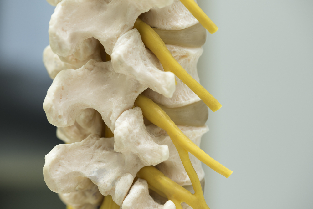 Spinal Stenosis Surgery: The Good News, Details, & the Facts
