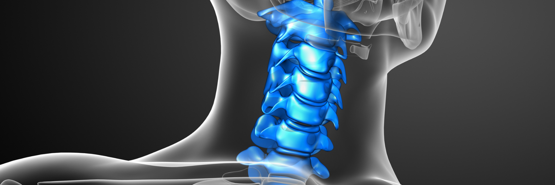 Cervical Spine Fusion: Do I Really Need Neck Surgery?