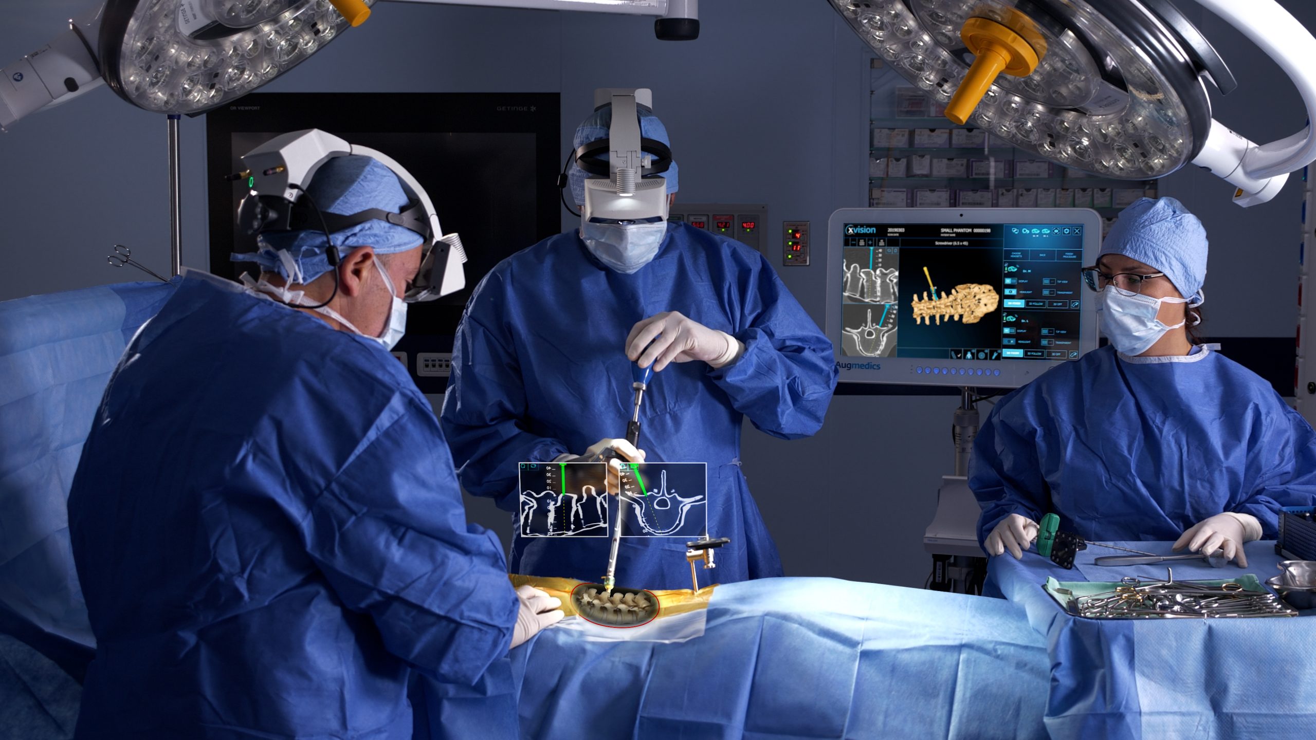 Rapid Recovery Spine Surgery