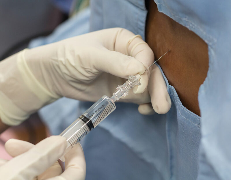 Recover Faster with Spinal Anesthesia