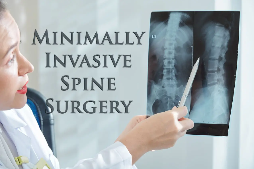 Awake Spinal Fusion 