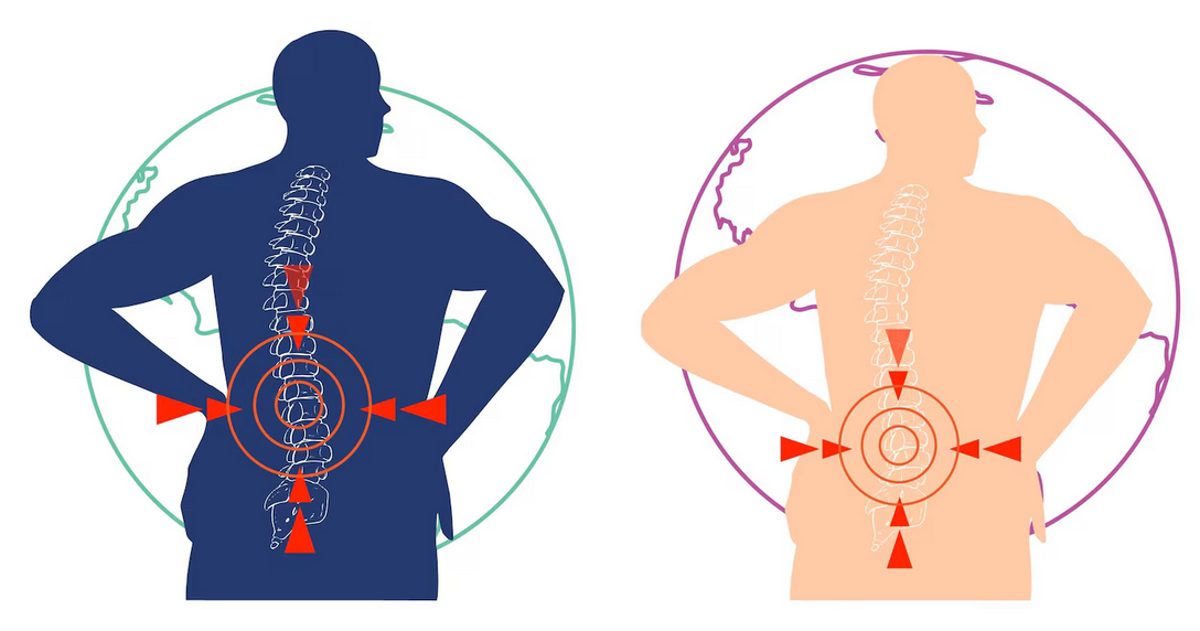 Accelerate Your Spinal Fusion Recovery: Proven Strategies for Better Outcomes