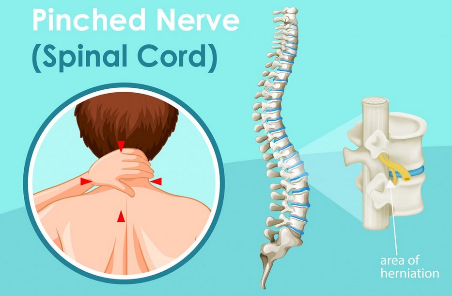 Spinal Cord Stimulator Placement: What Patients Should Know Before and After the Procedure