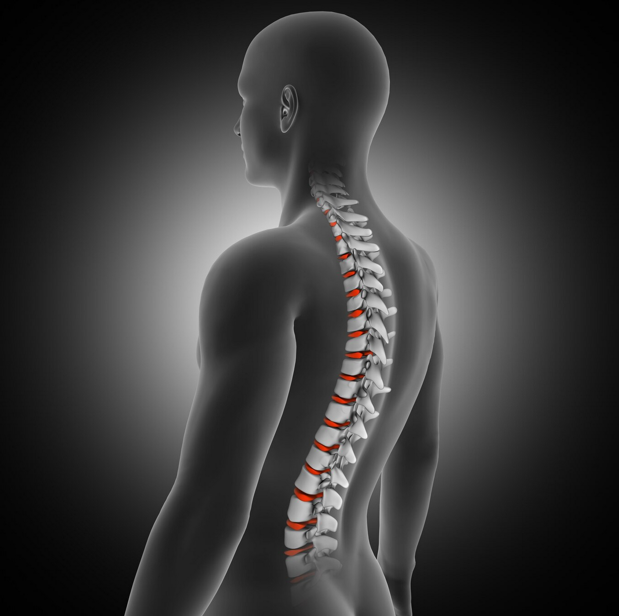 The Benefits and Risks of Lumbar Spinal Fusion Explained