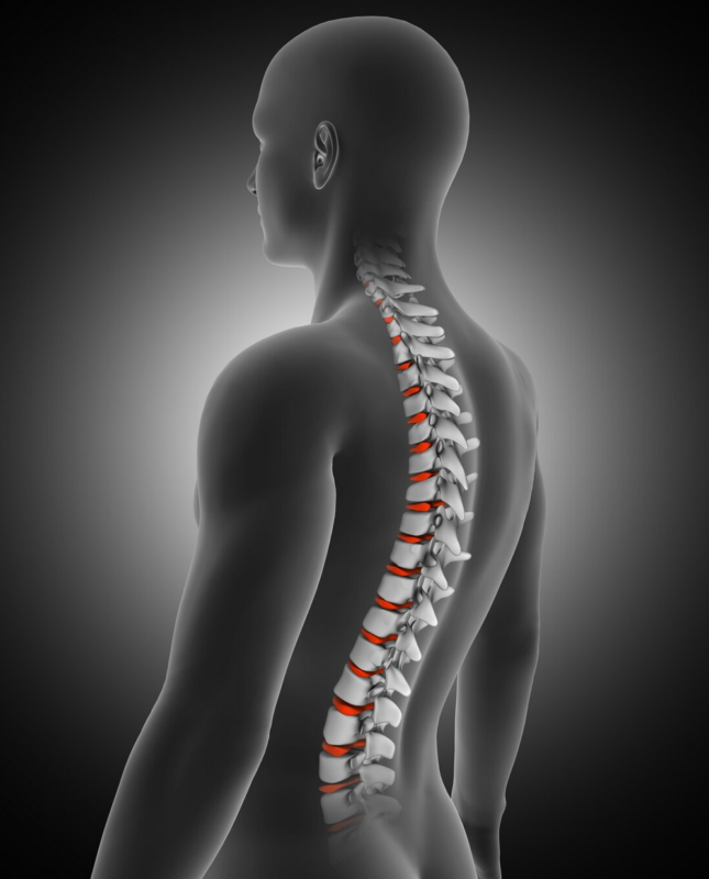 Lumbar Spinal Fusion
