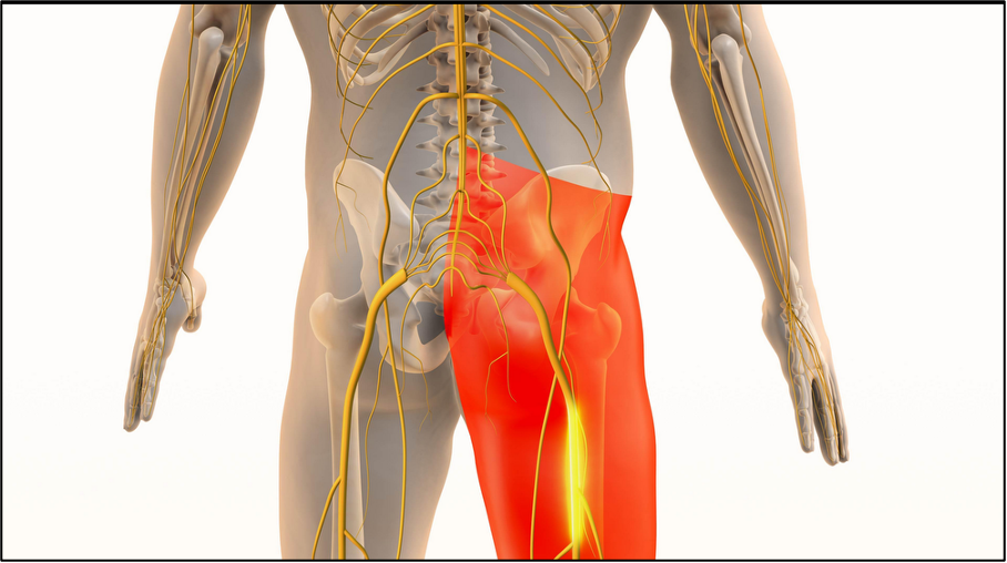 Sciatica Treatment in NJ