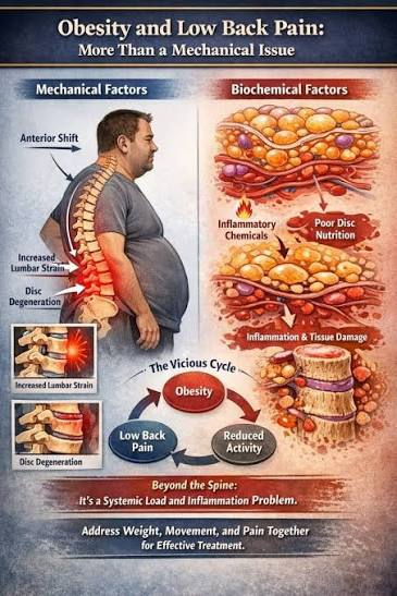 Can Being Less Active or Gaining Weight Affect My Spine?